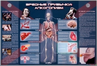 Электрифицированный стенд "Вредные привычки: алкоголизм" - «globural.ru» - Алапаевск