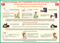 Таблица Порядок действий при опасном кровотечении 1000*1400 винил - «globural.ru» - Алапаевск